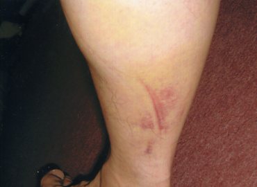 �C���X�u���b�N