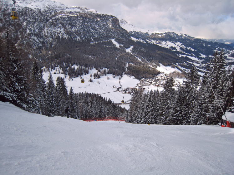 �A���^�o�f�B�A