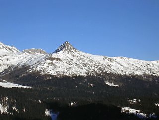 �A���^�v�X�e���A