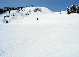 �C�I�b�N�X�A���[�U