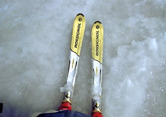 ����X�L�[